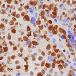 53BP1 Antibody (1285C) - Azide and BSA Free, Novus Biologicals 0.1 mg;
